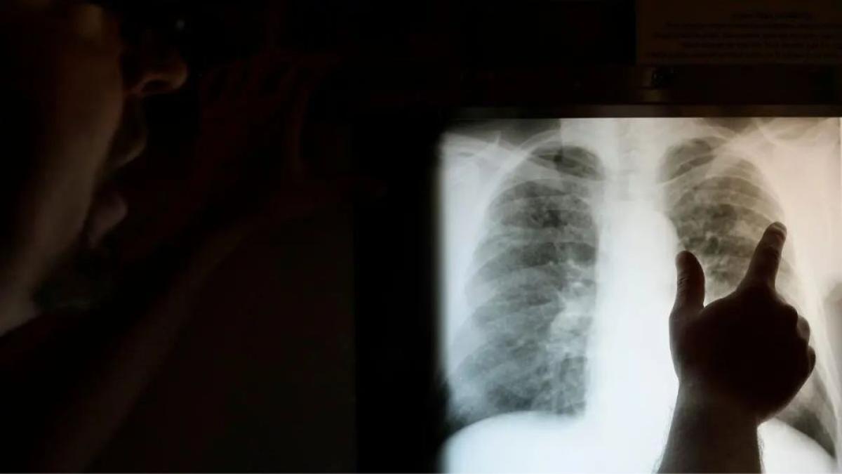 a person analyzing chest x ray