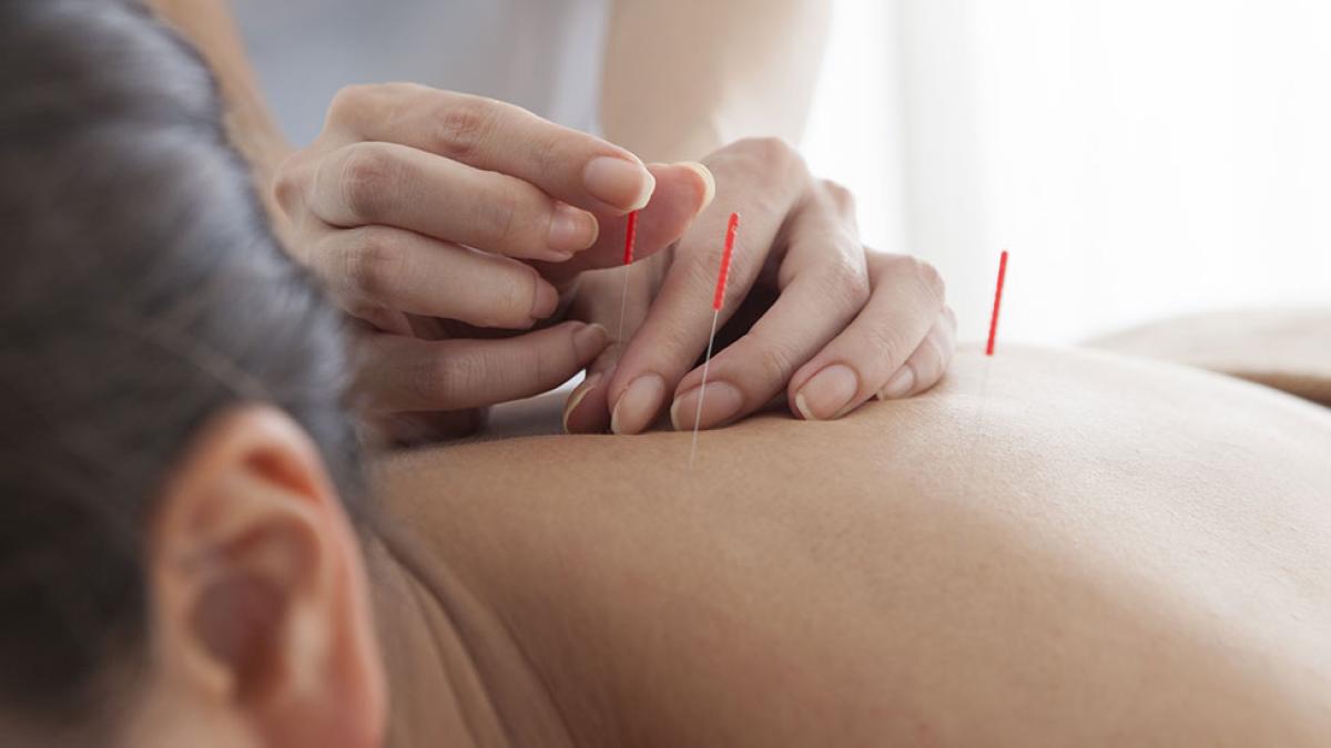 Close-up of someone receiving acupuncture.
