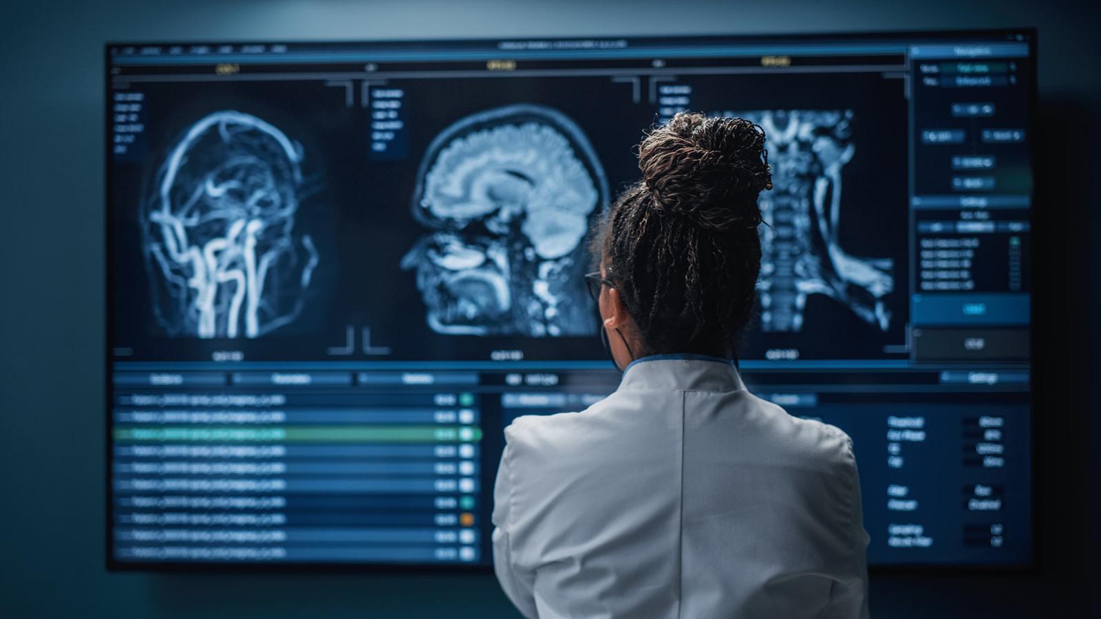 A scientist stands in front of some brain scans