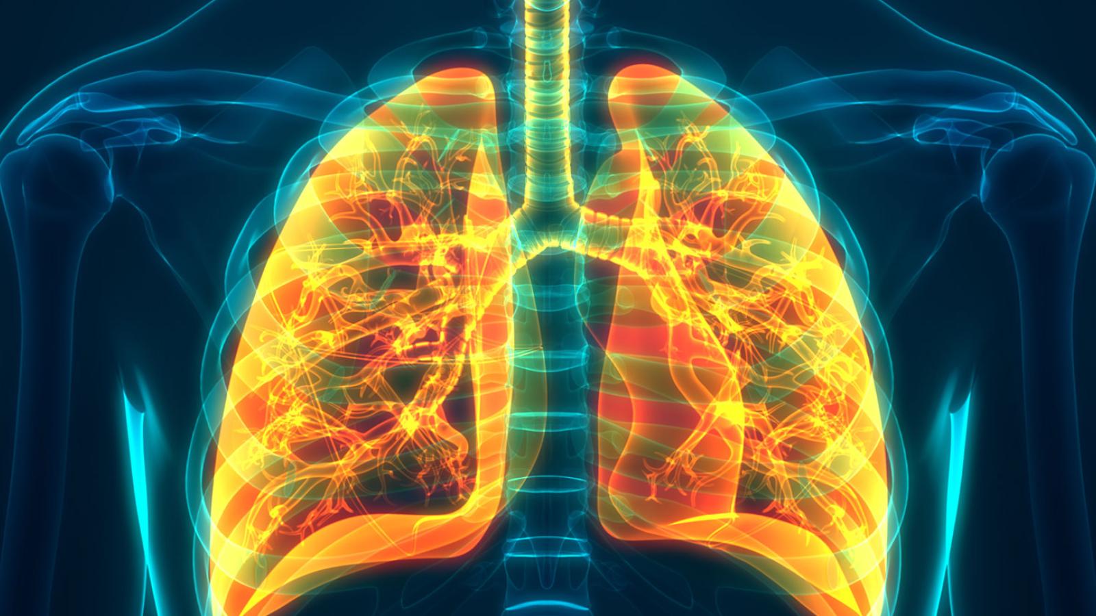 X-ray of a human lung.